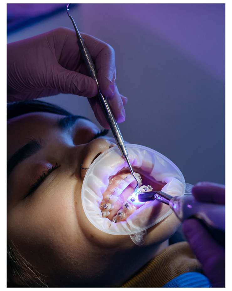 Laser Dentistry